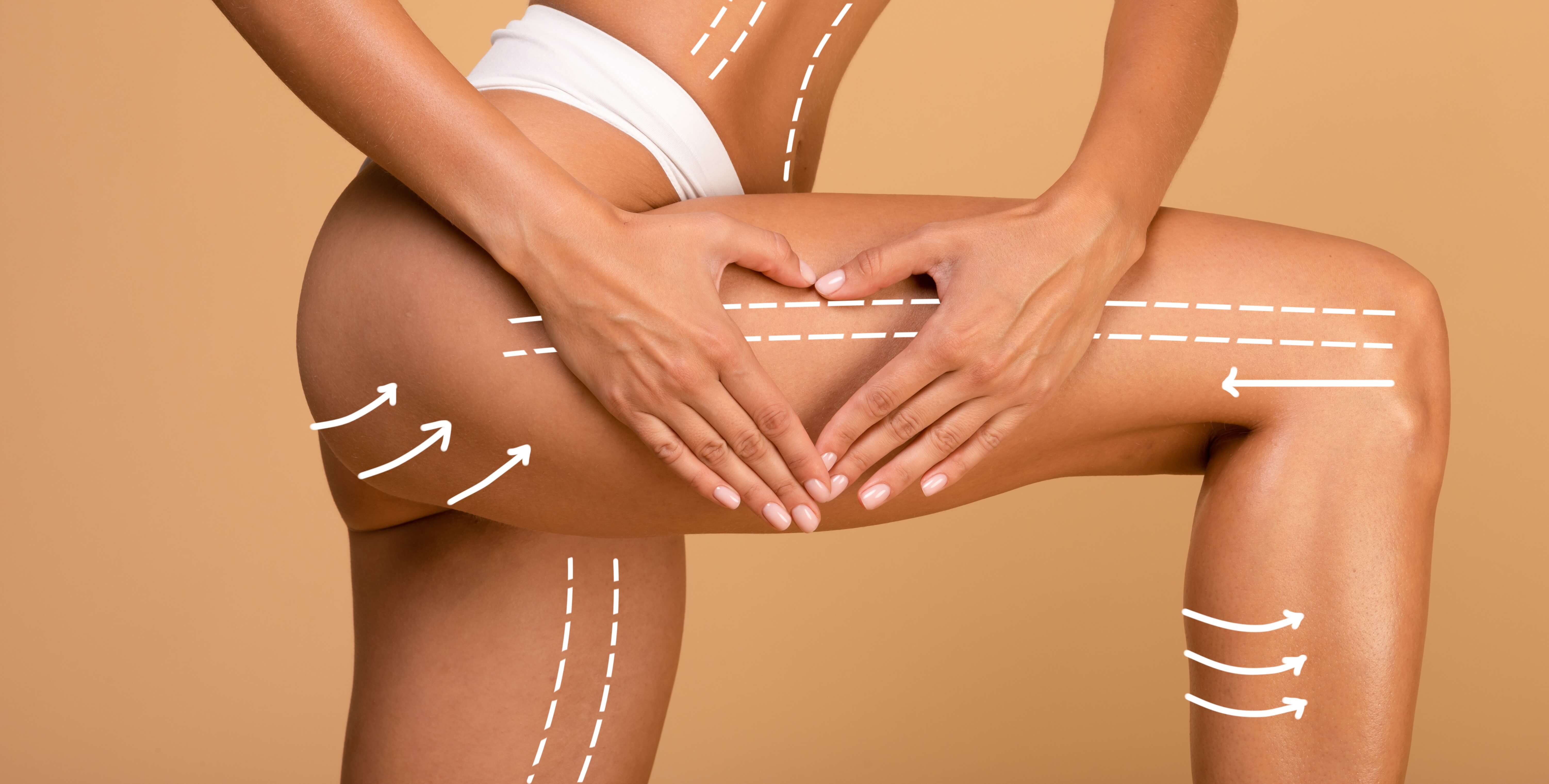 What is Thigh Lifting Surgery?